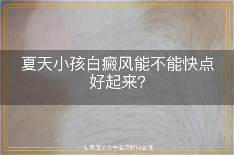 夏天小孩白癜风能不能快点好起来？