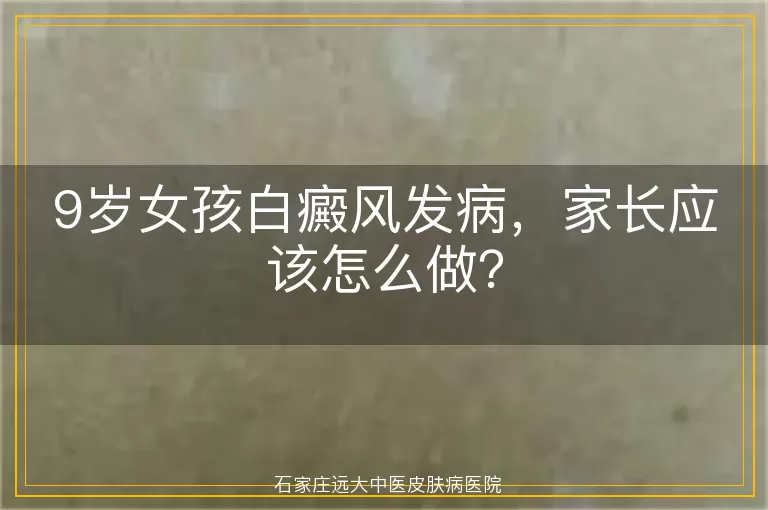 9岁女孩白癜风发病，家长应该怎么做？