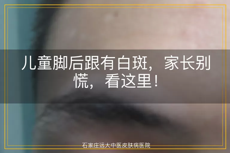 儿童脚后跟有白斑,家长别慌,看这里!