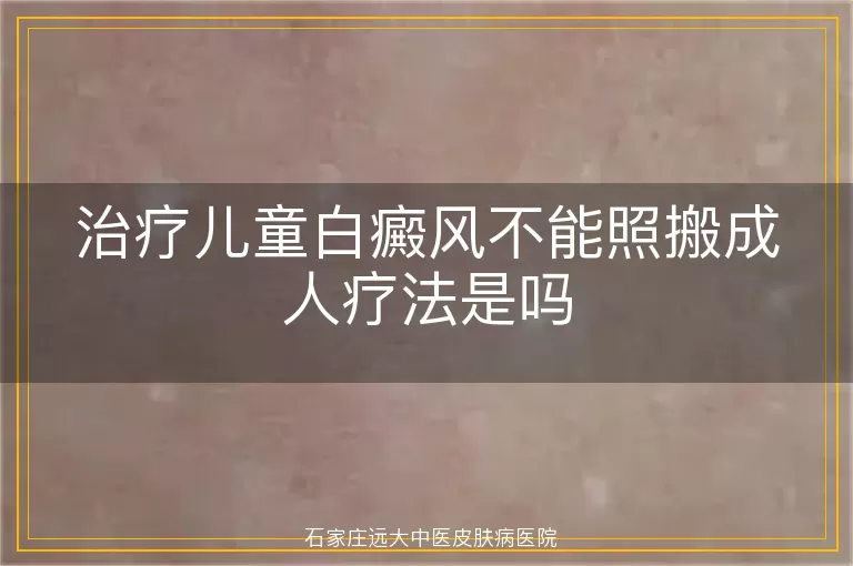 治疗儿童白癜风不能照搬成人疗法是吗