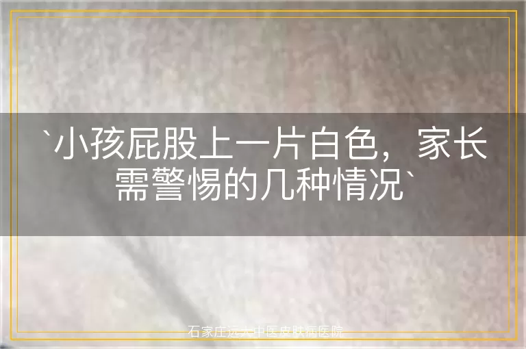 小孩屁股上一片白色，家长需警惕的几种情况