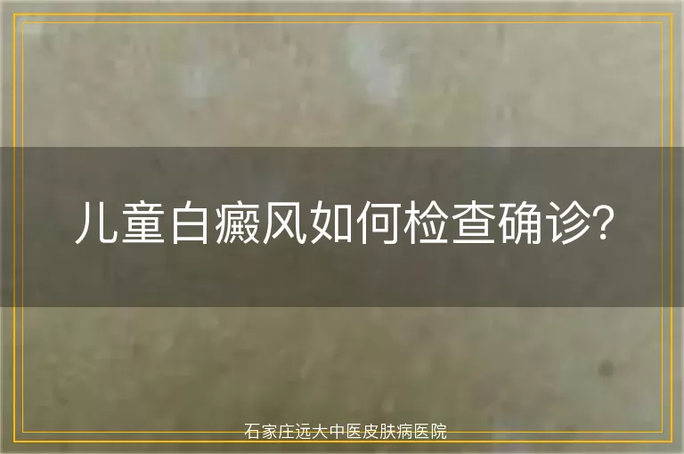 儿童白癜风如何检查确诊？