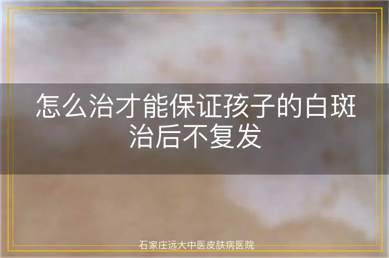 怎么治才能保证孩子的白斑治后不复发