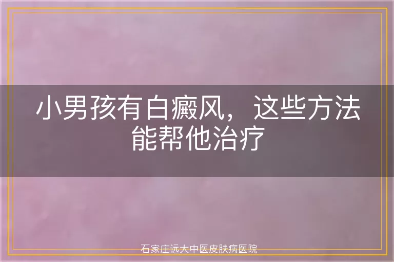 小男孩有白癜风,这些方法能帮他治疗