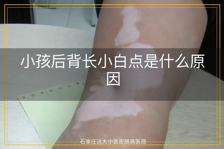 小孩后背长小白点是什么原因