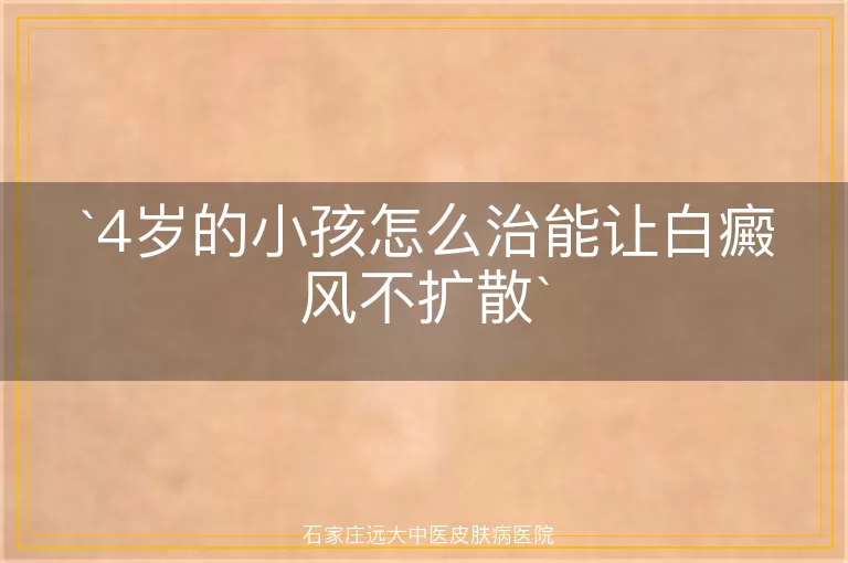 4岁的小孩怎么治能让白癜风不扩散