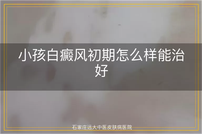 小孩白癜风初期怎么样能治好