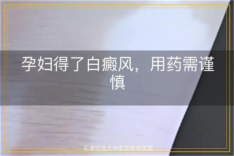 孕妇得了白癜风,用药需谨慎