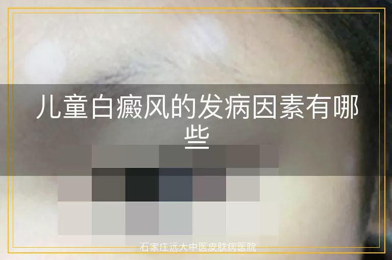 儿童白癜风的发病因素有哪些