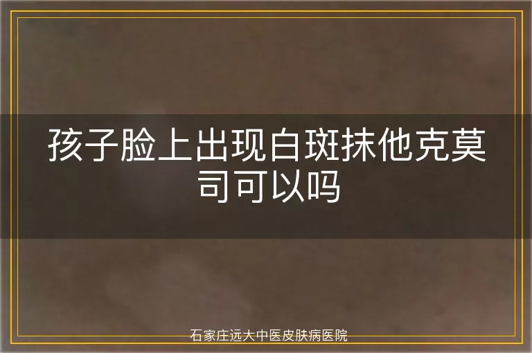 孩子脸上出现白斑抹他克莫司可以吗