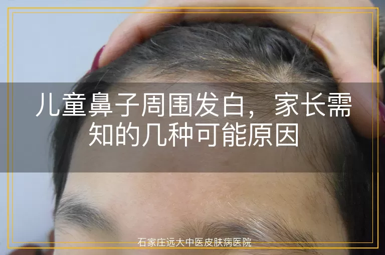 儿童鼻子周围发白，家长需知的几种可能原因