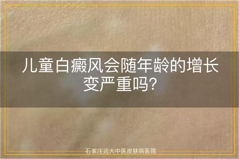 儿童白癜风会随年龄的增长变严重吗？