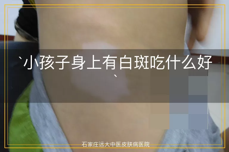 小孩子身上有白斑吃什么好