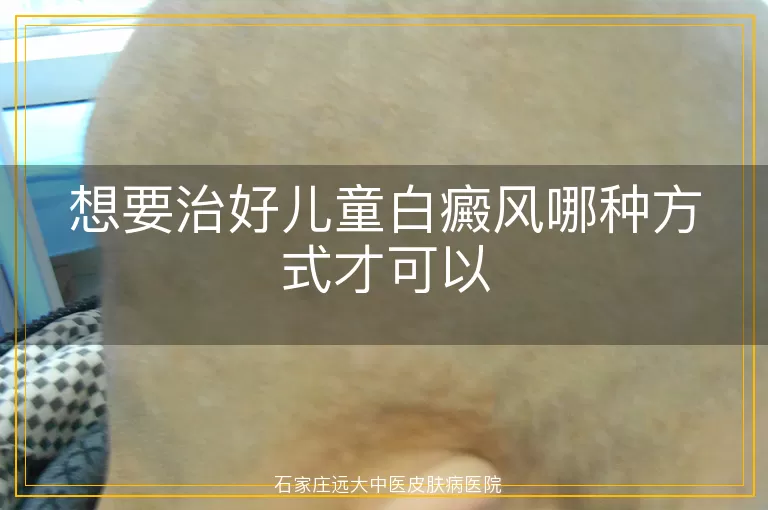 想要治好儿童白癜风哪种方式才可以
