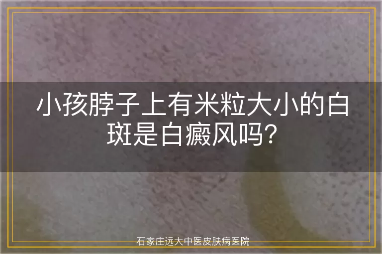 小孩脖子上有米粒大小的白斑是白癜风吗?