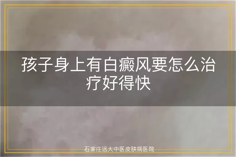 孩子身上有白癜风要怎么治疗好得快