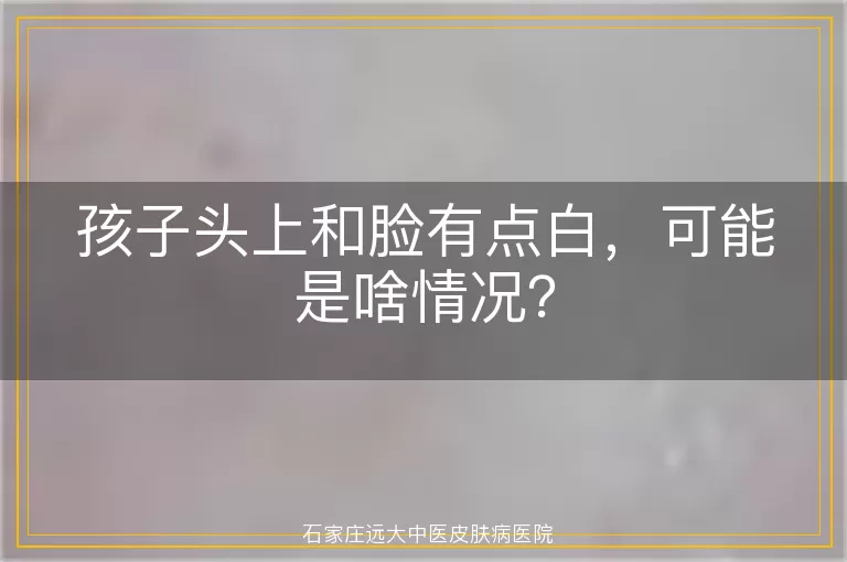 孩子头上和脸有点白，可能是啥情况？
