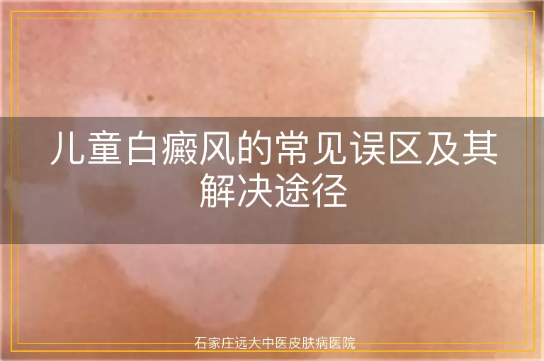 儿童白癜风的常见误区及其解决途径