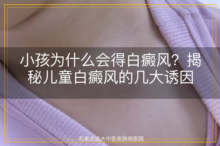 小孩为什么会得白癜风？揭秘儿童白癜风的几大诱因
