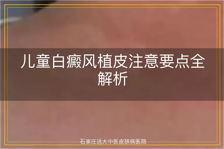 儿童白癜风植皮注意要点全解析