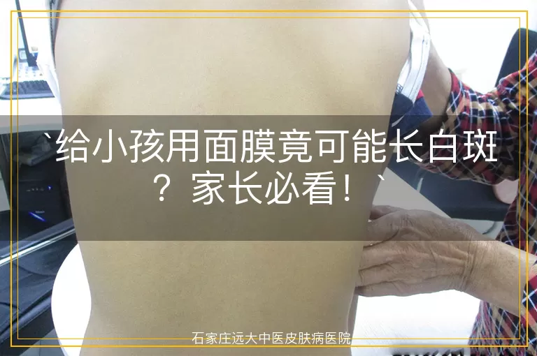 给小孩用面膜竟可能长白斑？家长必看！