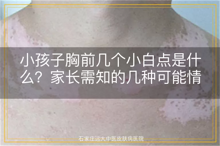 小孩子胸前几个小白点是什么？家长需知的几种可能情况