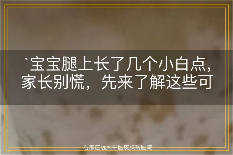 宝宝腿上长了几个小白点，家长别慌，先来了解这些可能的原因