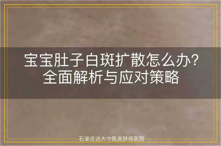 宝宝肚子白斑扩散怎么办？全面解析与应对策略