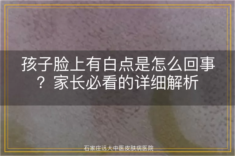 孩子脸上有白点是怎么回事？家长必看的详细解析