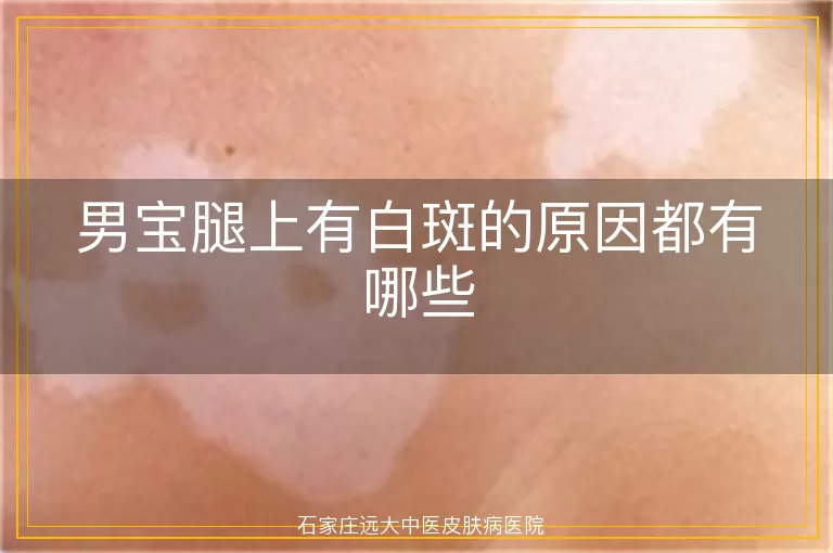 男宝腿上有白斑的原因都有哪些