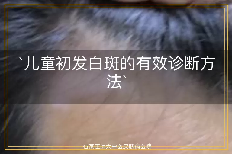 儿童初发白斑的有效诊断方法