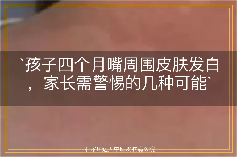 孩子四个月嘴周围皮肤发白，家长需警惕的几种可能