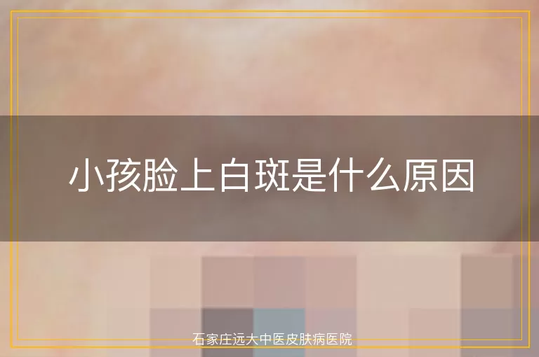 小孩脸上白斑是什么原因