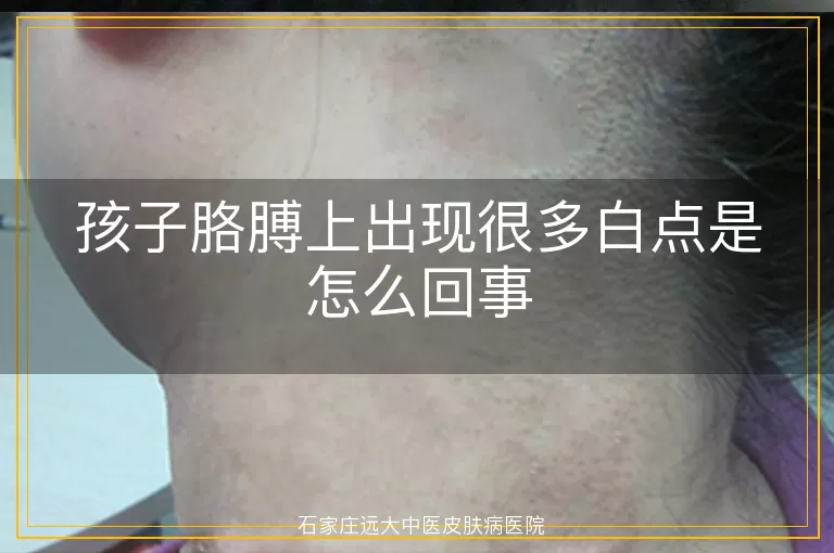 孩子胳膊上出现很多白点是怎么回事