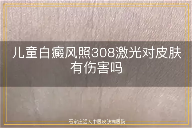 儿童白癜风照308激光对皮肤有伤害吗
