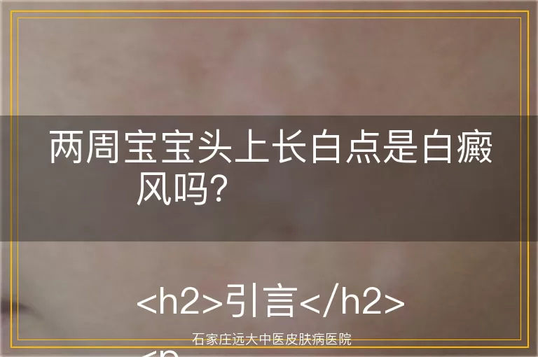 两周宝宝头上长白点是白癜风吗？

<h2>引言</h2>
<p>嘿，新手爸妈们，是不是发现自家两周大的小宝宝头上突然出现了小白点，心里那个急啊？别担心，咱们今天就来聊聊这个话题——两周宝宝头上长白点，到底是不是白癜风呢？</p>

<h2>白癜风的基本了解</h2>
<p>首先，咱们得知道啥是白癜风。白癜风啊，是一