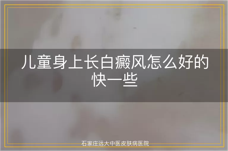 儿童身上长白癜风怎么好的快一些