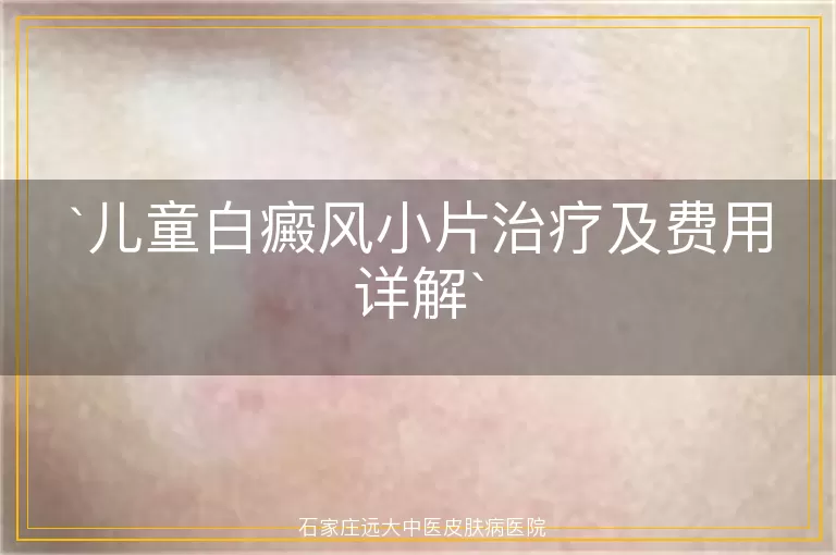 儿童白癜风小片治疗及费用详解