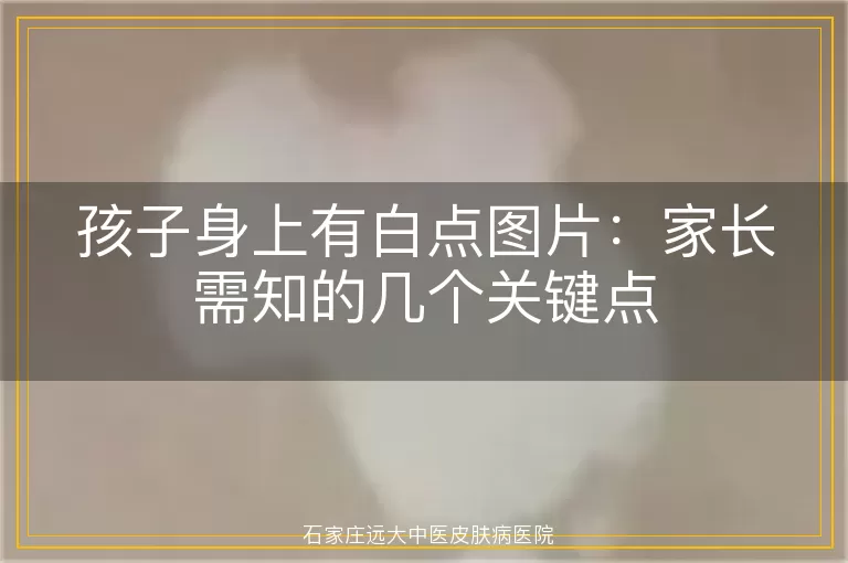 孩子身上有白点图片：家长需知的几个关键点