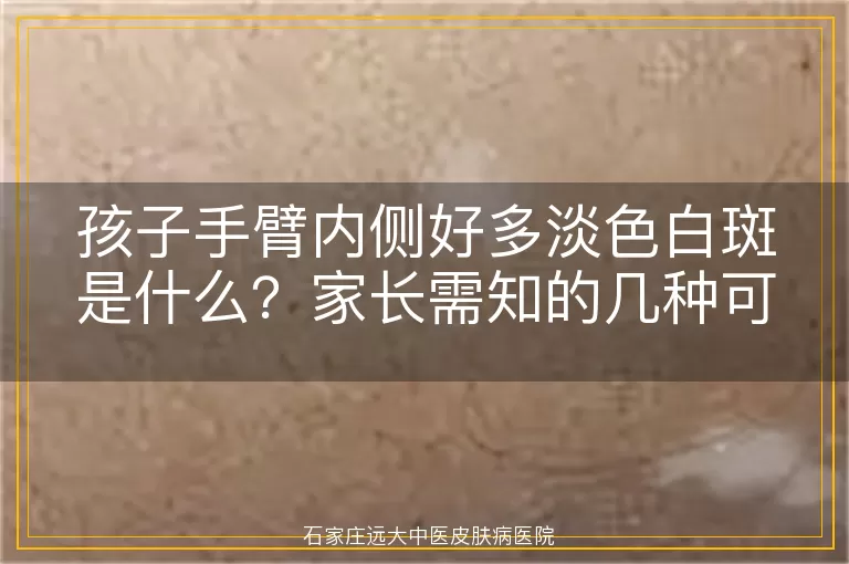 孩子手臂内侧好多淡色白斑是什么？家长需知的几种可能情况