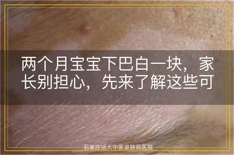 两个月宝宝下巴白一块，家长别担心，先来了解这些可能的原因