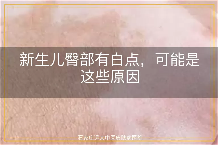 新生儿臀部有白点，可能是这些原因