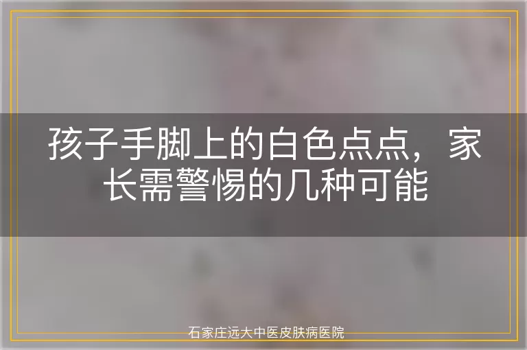 孩子手脚上的白色点点，家长需警惕的几种可能