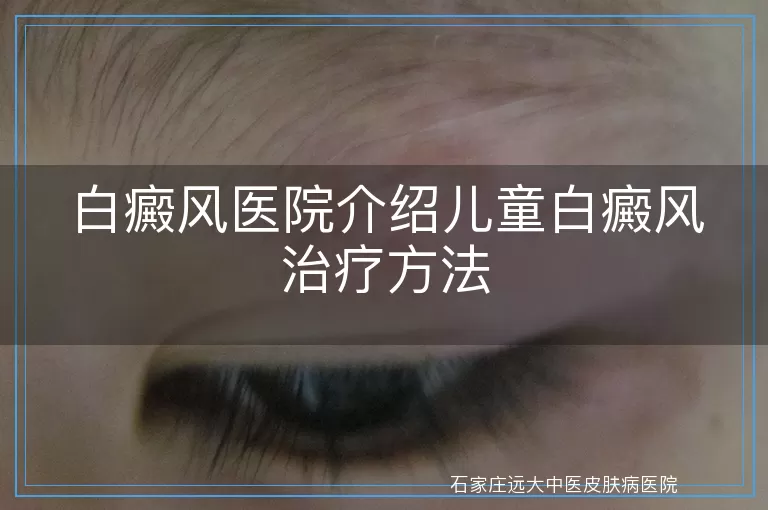 白癜风医院介绍儿童白癜风治疗方法