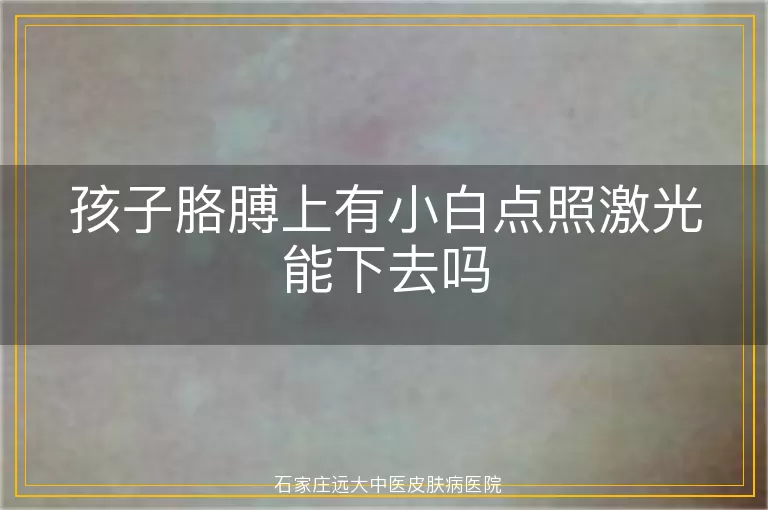 孩子胳膊上有小白点照激光能下去吗