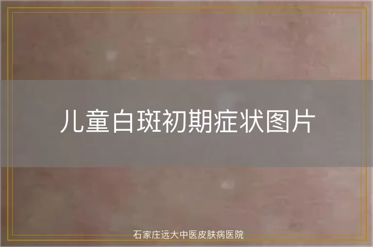 儿童白斑初期症状图片