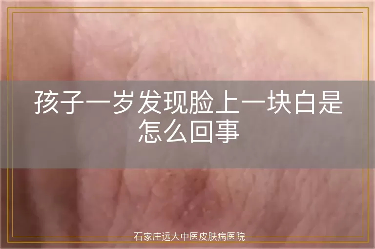 孩子一岁发现脸上一块白是怎么回事