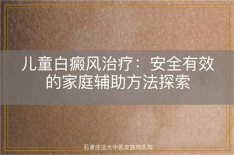 儿童白癜风治疗：安全有效的家庭辅助方法探索