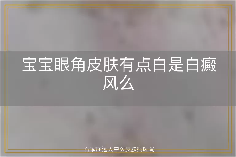 宝宝眼角皮肤有点白是白癜风么