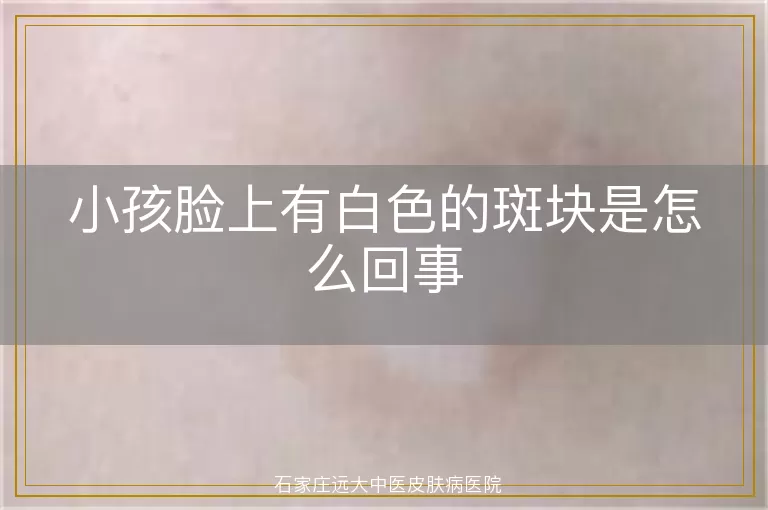 小孩脸上有白色的斑块是怎么回事